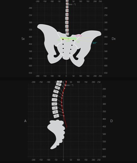 Analisi strumentale del bacino visto da dietro e delle curve della colonna di profilo