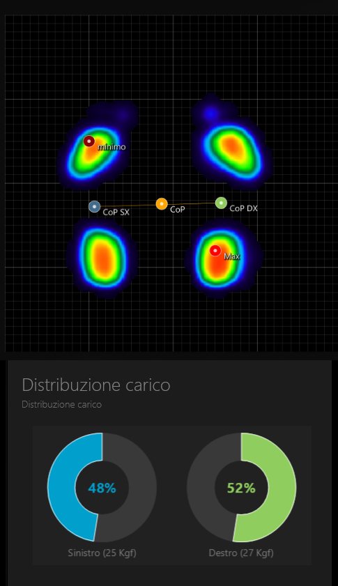 Mappa di pressione plantare e distribuzione del carico dopo il percorso: 48% a sinistra, 52% a destra