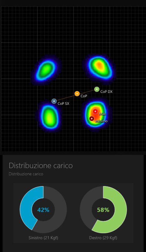 Mappa di pressione plantare e distribuzione del carico all'inizio del percorso: 42% a sinistra, 58% a destra