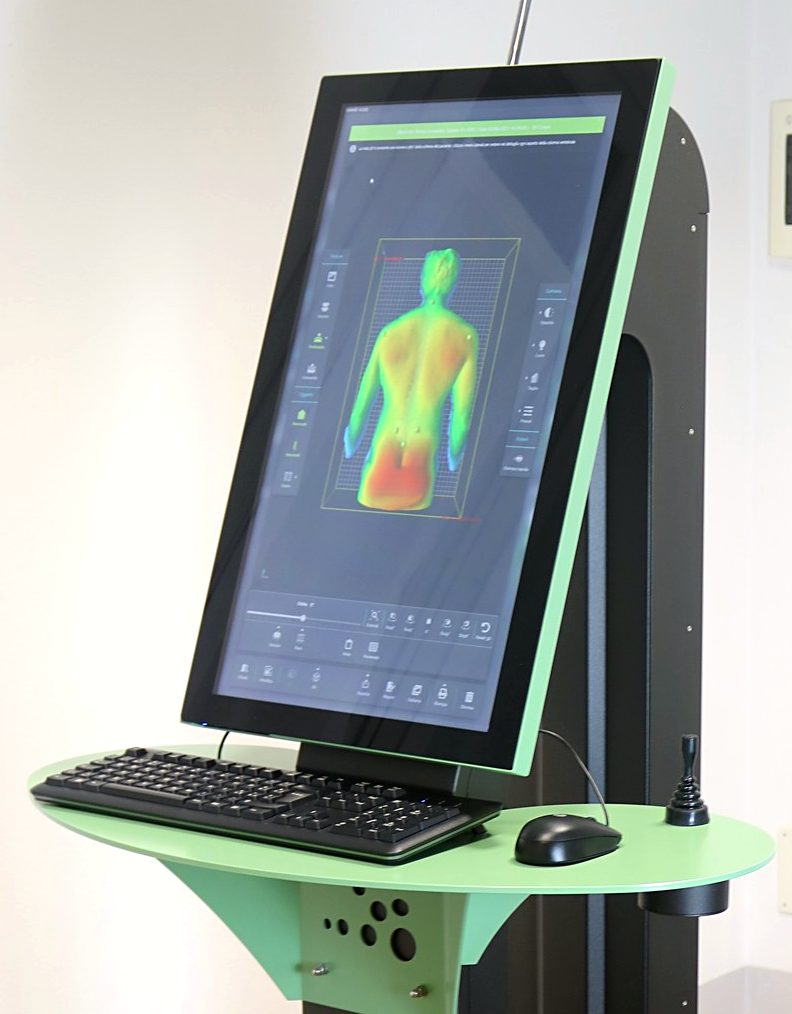La postazione Spine 3D con la scansione tridimensionale della colonna a schermo