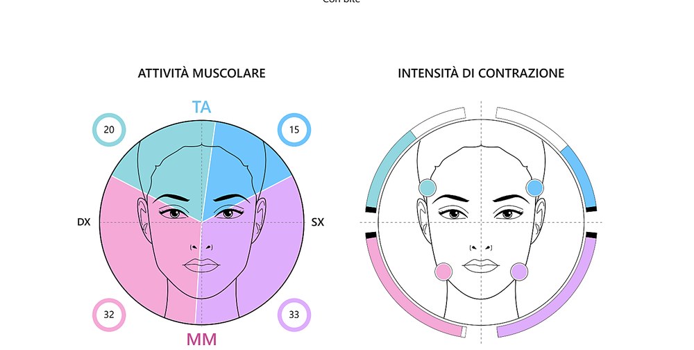 Referto Teethan: attività dei muscoli masticatori, destra e sinistra a confronto