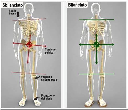 Hai una gamba corta?