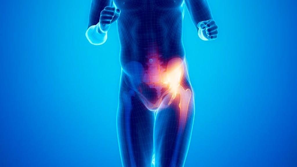 SOFFRI DI PUBALGIA?